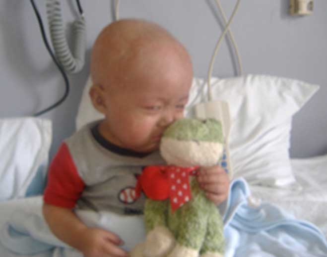 alex-leukemia-story-659x519